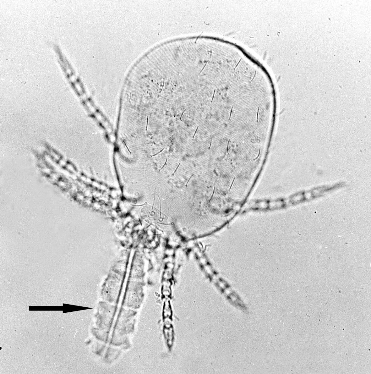 Chigger larva under microscope with stylostome feeding tube indicated